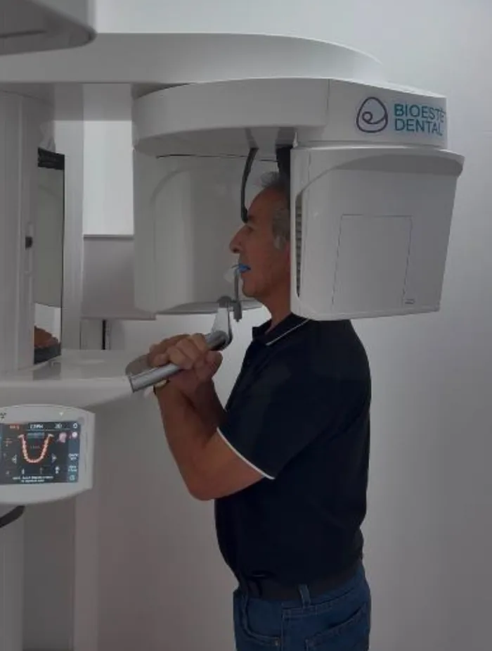Escáner CBCT 3D de Bioestética Dental usado para la planeación digital del implante